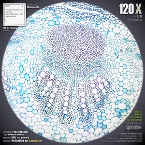 Haz vascular colateral abierto